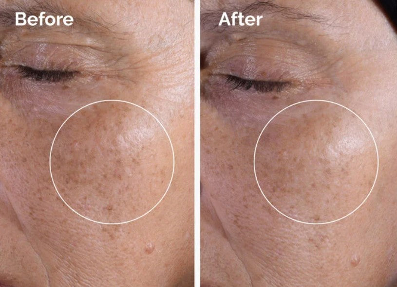 The Ordinary Tónico exfoliante de ácido glicólico al 7%