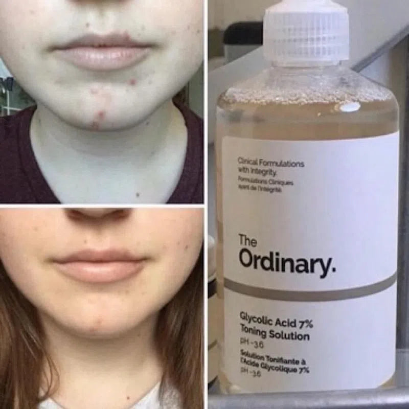 The Ordinary Tónico exfoliante de ácido glicólico al 7%